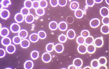 Blood count of a test person under the dark field microscope