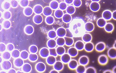 Formule sanguine d'un sujet sous le microscope à fond noir après l'utilisation d'un memonizerMOBILE