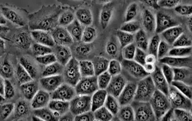 Zellstruktur unter dem Mikroskop und Elektrosmogeinfluss und Einsatz der memon Technologie