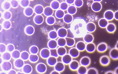 Blood count of a test person under the dark field microscope after using a memonizerMOBILE