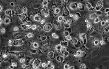 Zerstörte Zellstruktur unter einem Mikroskop nach Elektrosmogeinfluss