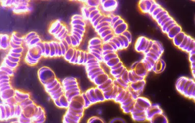 Analyse de sang Microscope à fond noir Blutbild eines Probanden unter dem Dunkelfeldmikroskop nach 10 Minuten Handytelefonat